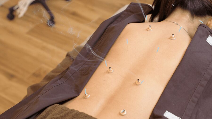 Hiroshima: Acupuncture and Japanese unique massage treatment - Who will get the most from this experience